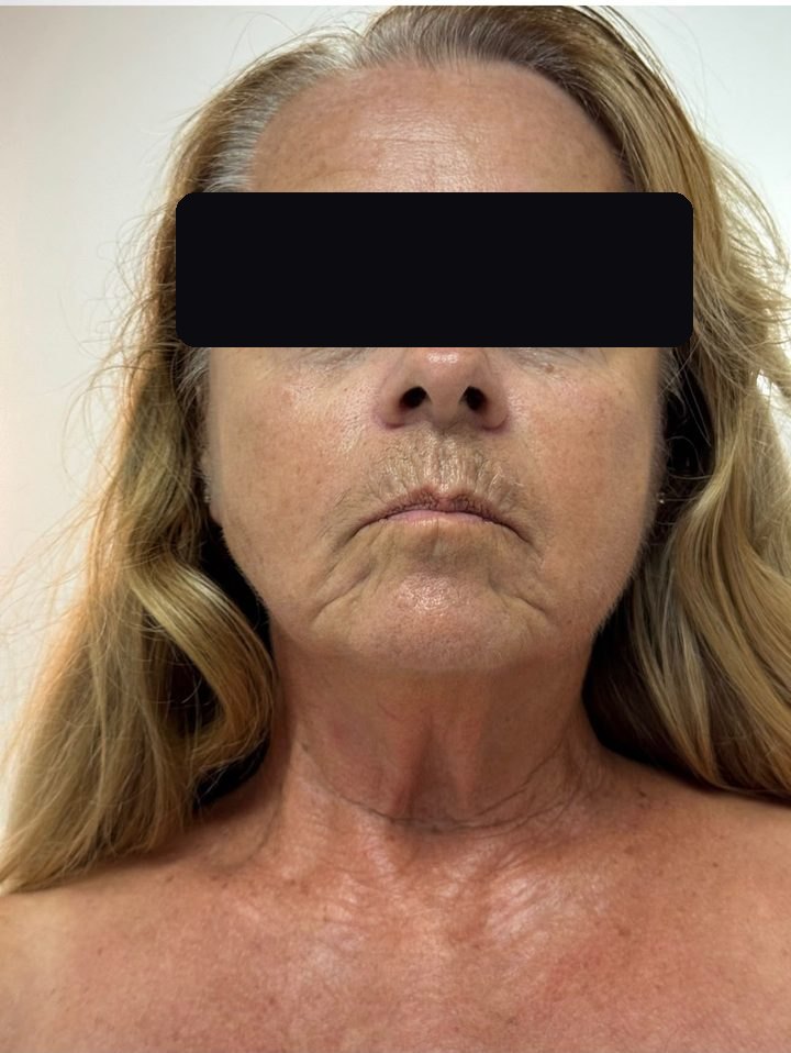 Same client after treatment