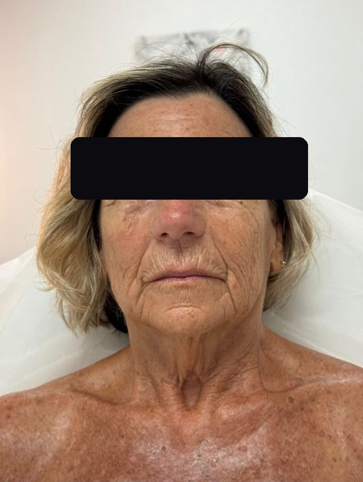 Same client after treatment