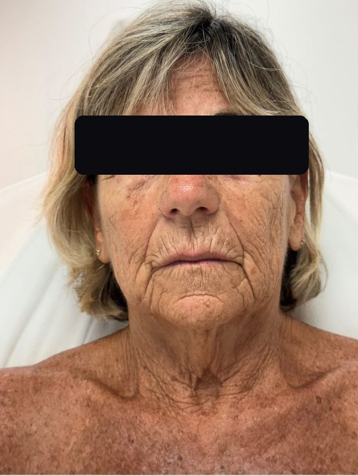 Client before treatment