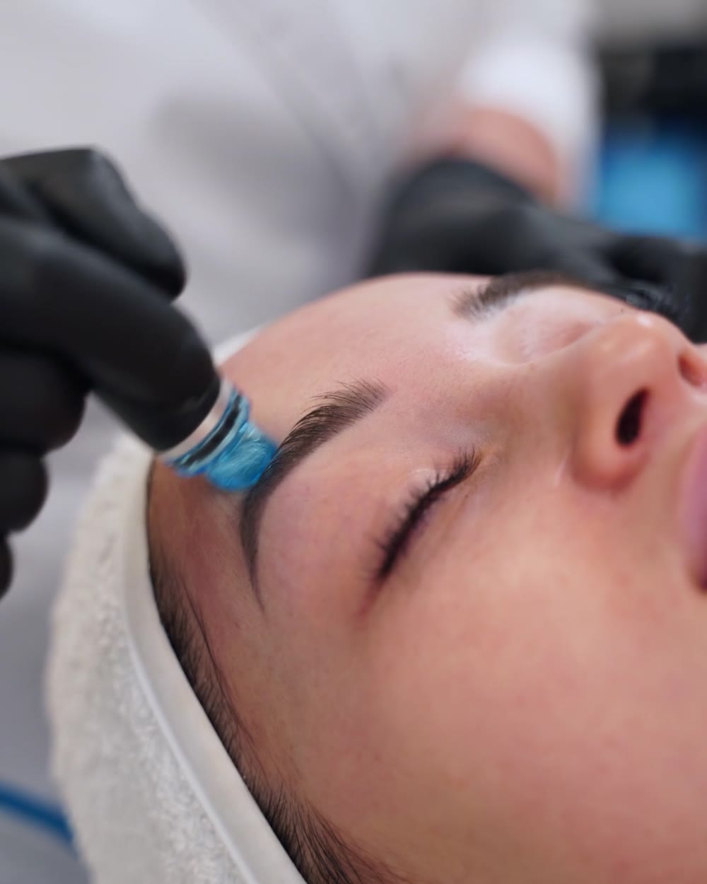 HydroFacial wand cleansing a client's forehead